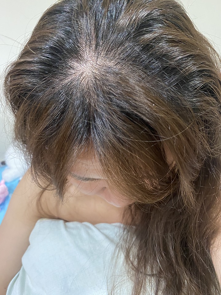 告別油膩膩 開心又美麗 — Alpecin Scalp care 專業頭皮護理系列