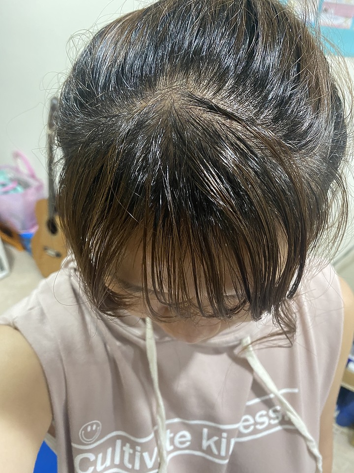 告別油膩膩 開心又美麗 — Alpecin Scalp care 專業頭皮護理系列