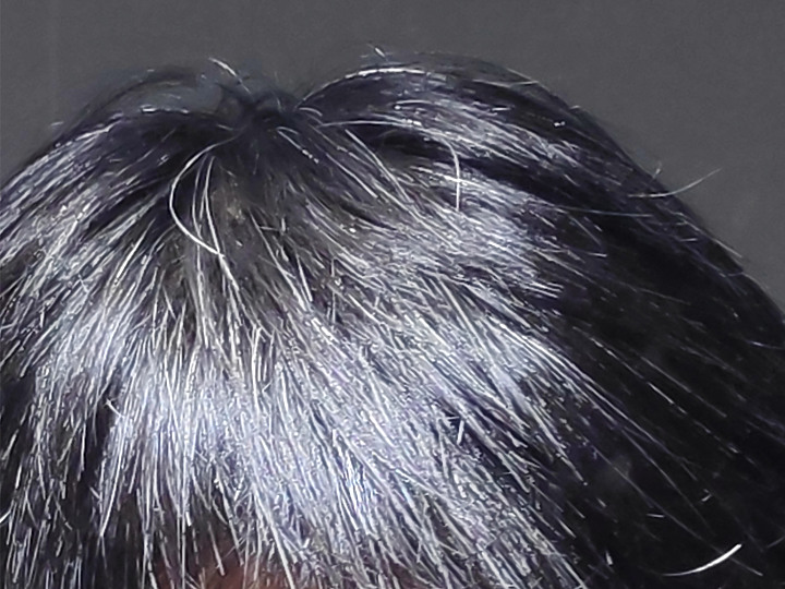 【外星貓開箱】Alpecin Scalp Care 專業頭皮護理系列~讓你與惱人的油膩頭皮說再見！