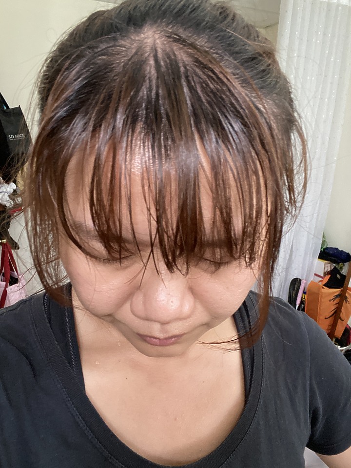 告別油膩膩 開心又美麗 — Alpecin Scalp care 專業頭皮護理系列