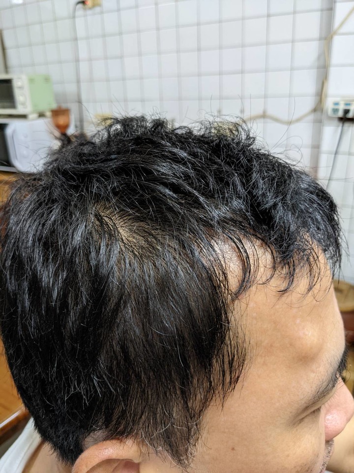 【Alpecin Scalp care】想告別油頭的困擾嗎？由整天油膩膩的廚師告訴你答案