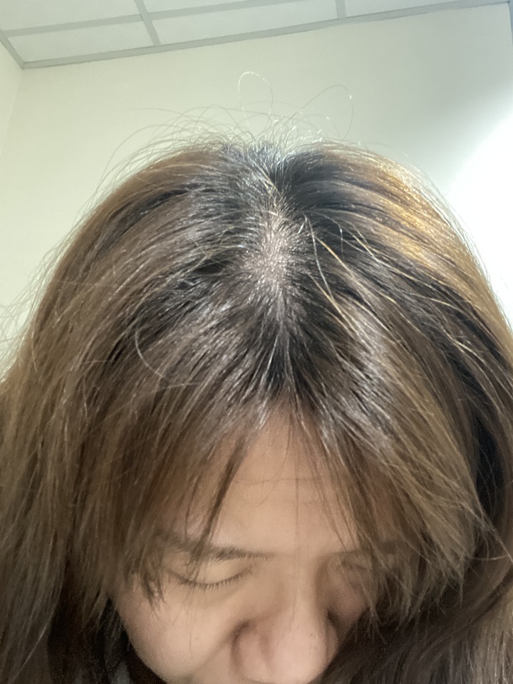 告別油膩膩 開心又美麗 — Alpecin Scalp care 專業頭皮護理系列