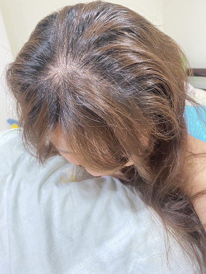 告別油膩膩 開心又美麗 — Alpecin Scalp care 專業頭皮護理系列