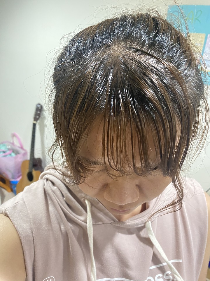 告別油膩膩 開心又美麗 — Alpecin Scalp care 專業頭皮護理系列
