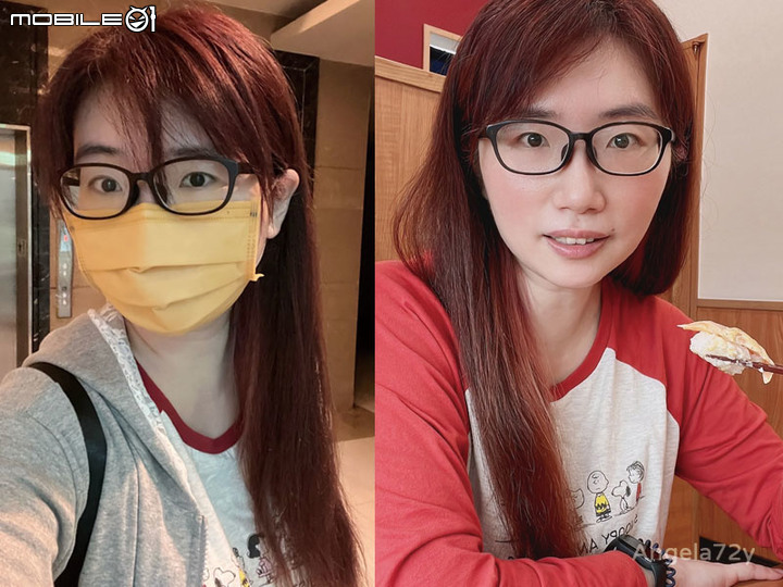 油臉敏感肌醫美小白第一次皮秒雷射! 斑掉下來!!