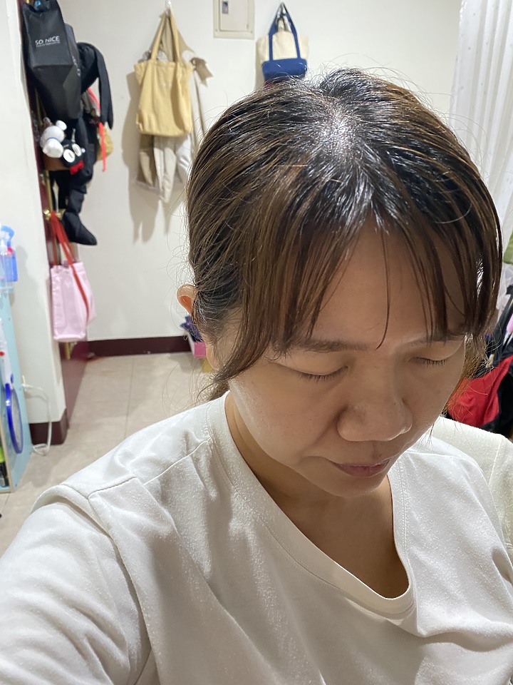 告別油膩膩 開心又美麗 — Alpecin Scalp care 專業頭皮護理系列