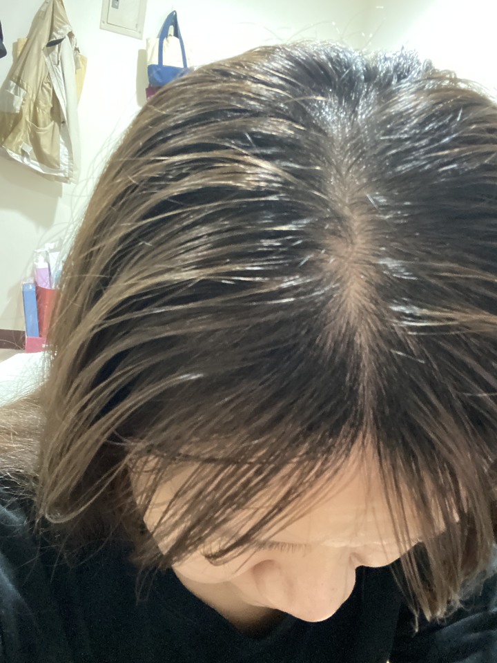 告別油膩膩 開心又美麗 — Alpecin Scalp care 專業頭皮護理系列