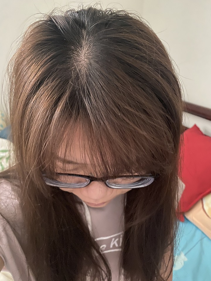 告別油膩膩 開心又美麗 — Alpecin Scalp care 專業頭皮護理系列