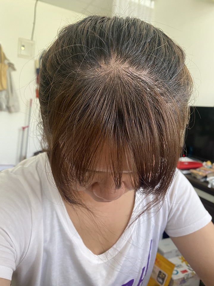 告別油膩膩 開心又美麗 — Alpecin Scalp care 專業頭皮護理系列