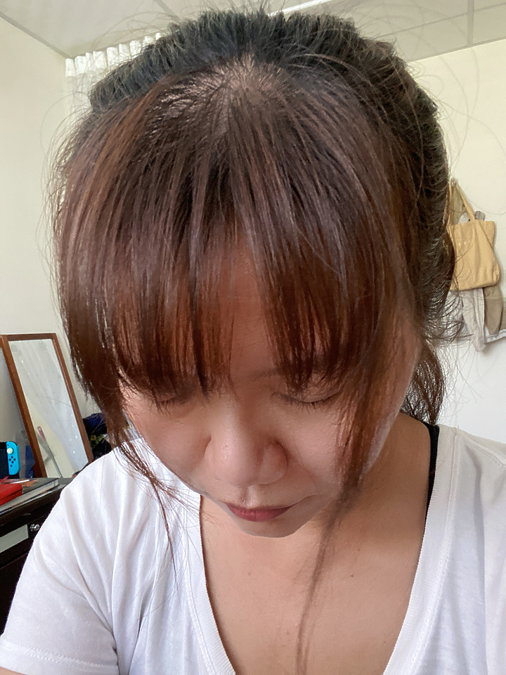 告別油膩膩 開心又美麗 — Alpecin Scalp care 專業頭皮護理系列