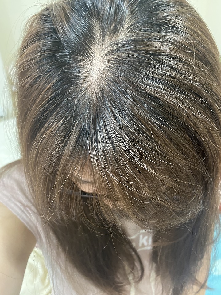 告別油膩膩 開心又美麗 — Alpecin Scalp care 專業頭皮護理系列