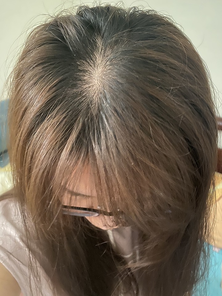 告別油膩膩 開心又美麗 — Alpecin Scalp care 專業頭皮護理系列