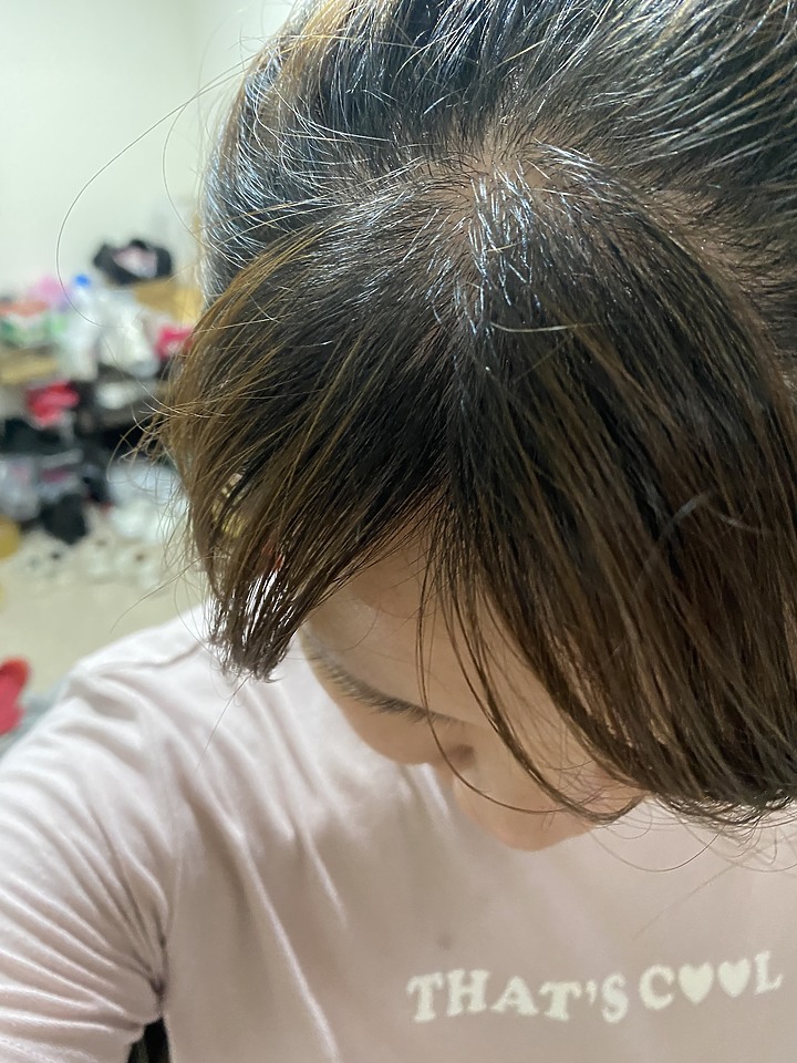 告別油膩膩 開心又美麗 — Alpecin Scalp care 專業頭皮護理系列