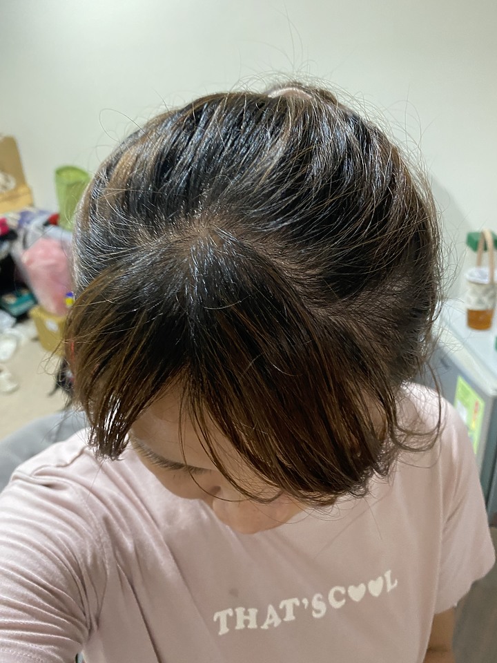 告別油膩膩 開心又美麗 — Alpecin Scalp care 專業頭皮護理系列