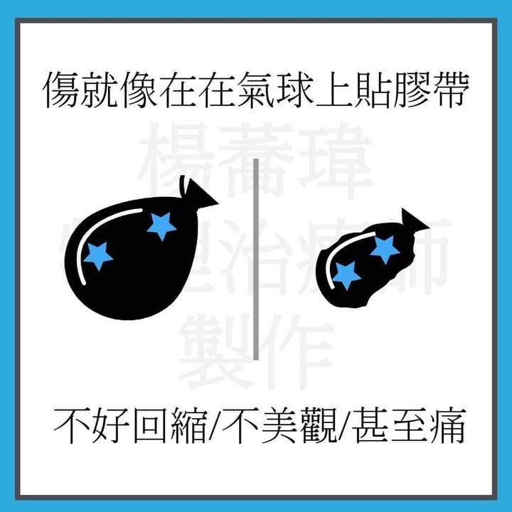 產後喬骨盆??