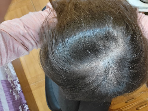 irestore雷射生髮帽開箱心得 (含雅諾士小比較)