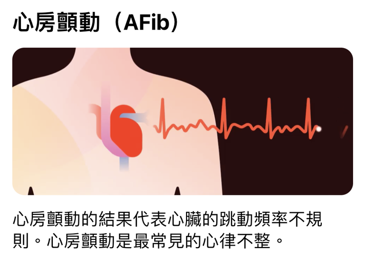 台灣開放 心電圖 ECG App v2.0了！ 直接更新即可！