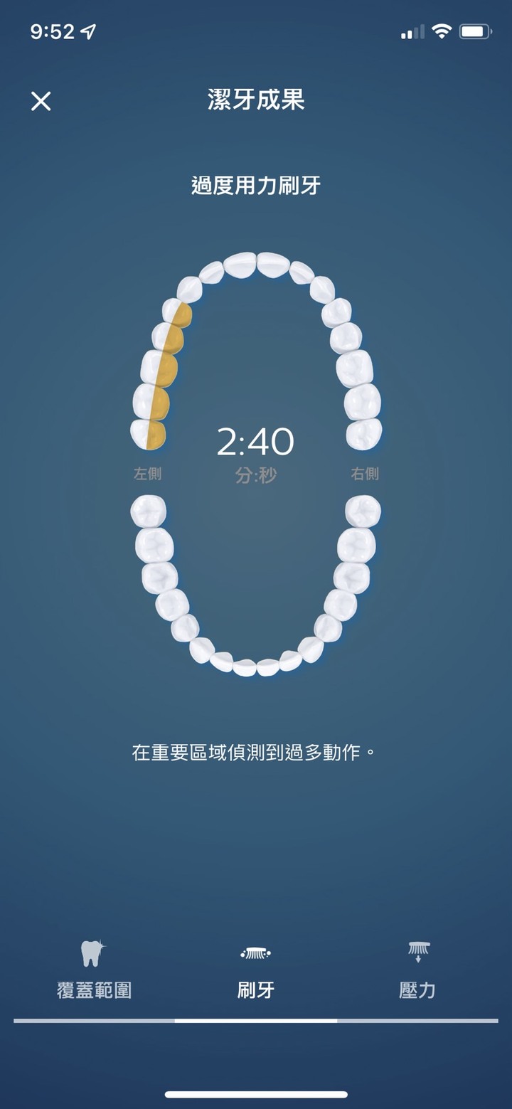 汰舊換新~ 開箱 Philips飛利浦 頂級AI智能電動牙刷