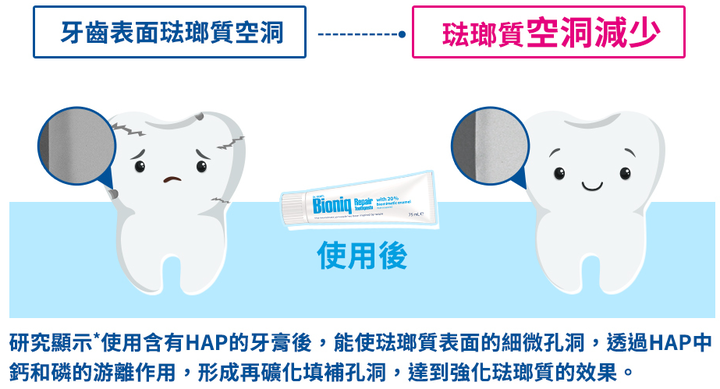 【打卡樓】告別敏感性牙齒丨分享體驗Dr. Wolff Bioniq® 貝歐尼專業修護牙膏，就能拿500電子禮券！
