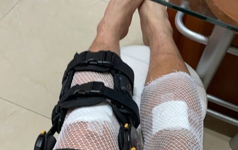 ACL斷裂開箱─垂直律動機(高島)