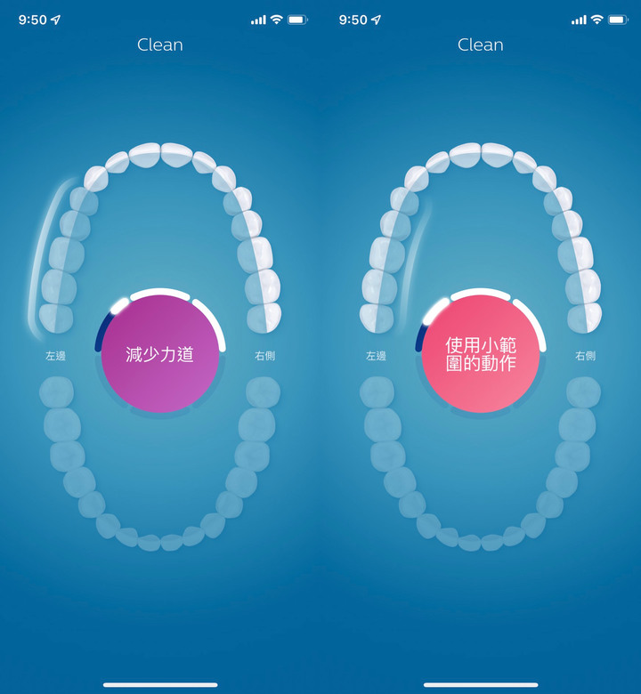 汰舊換新~ 開箱 Philips飛利浦 頂級AI智能電動牙刷