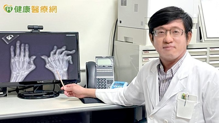 炒菜無法施力竟是類風濕性關節炎作怪！