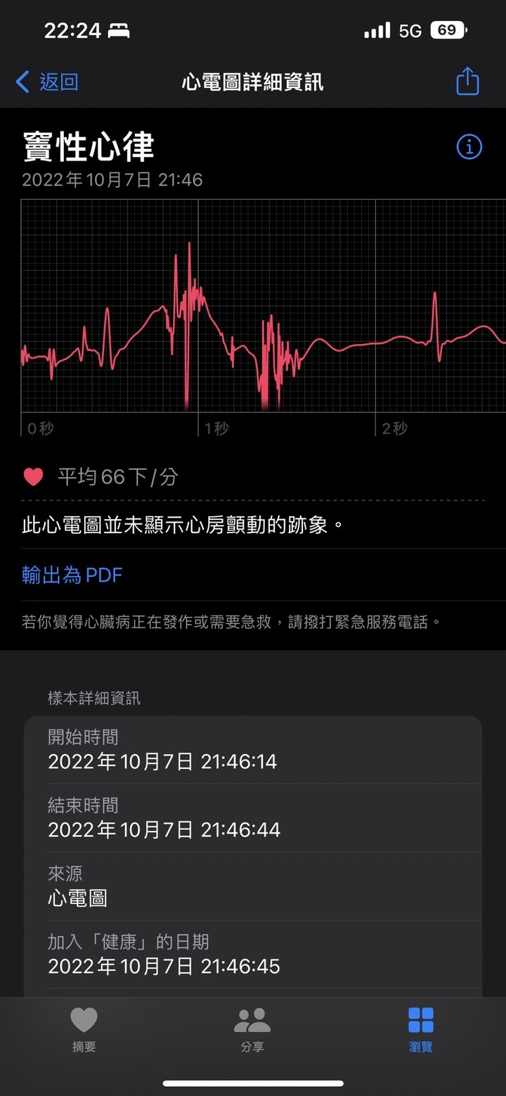 APPLE ECG