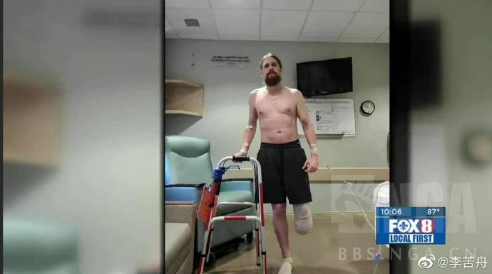 似乎很少报道：新冠血栓不得不截肢