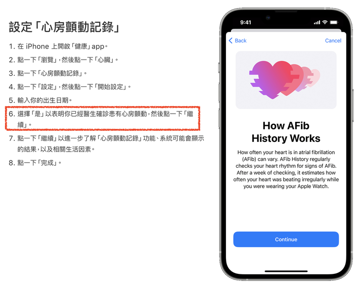 有出國的朋友，記得啟用WatchOS 9 心房顫動功能！回台仍可使用！