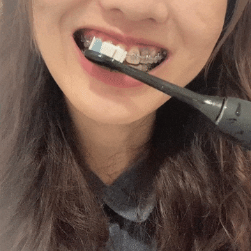 飛利浦 Sonicare「煥白閃耀智能鑽石音波電動牙刷 」｜一週有感煥白，初使用體驗！