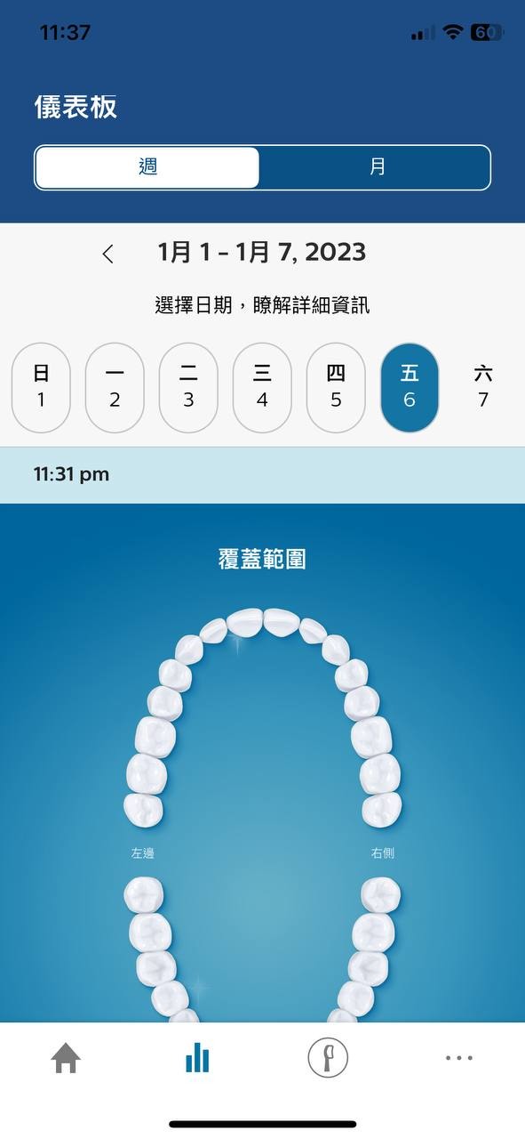 讓我老婆也有國民老婆般的美麗笑容 - 飛利浦 Sonicare智能鑽石機,邀你挑戰三天有感鑽白,打造自信微笑魅力