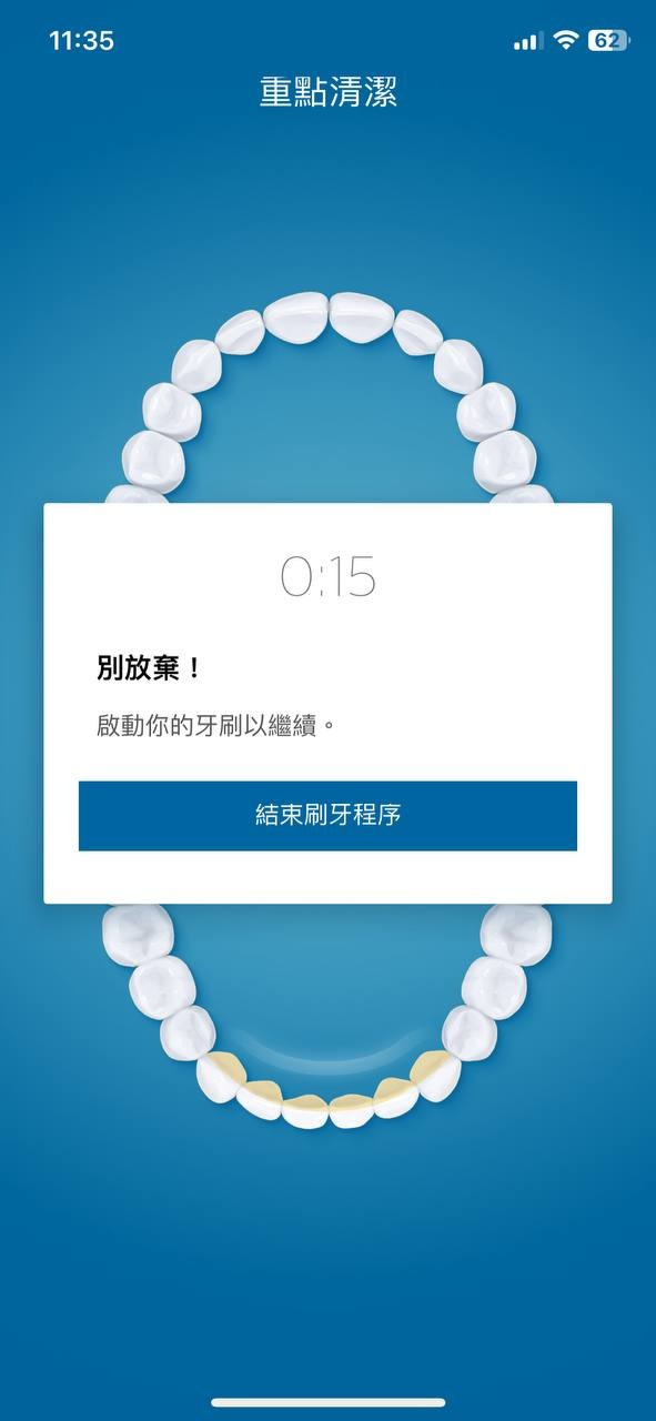 讓我老婆也有國民老婆般的美麗笑容 - 飛利浦 Sonicare智能鑽石機,邀你挑戰三天有感鑽白,打造自信微笑魅力