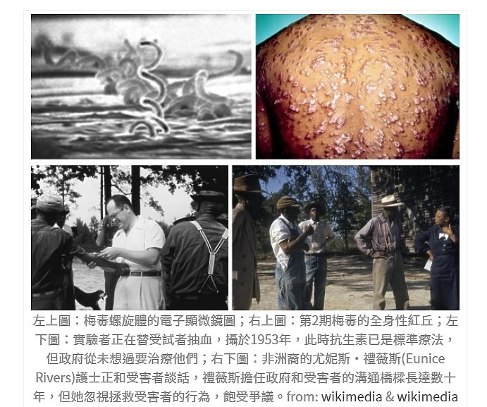 科學簡史】納粹醫師心中的惡魔–人體試驗的黑暗史 ( 友善轉貼 )