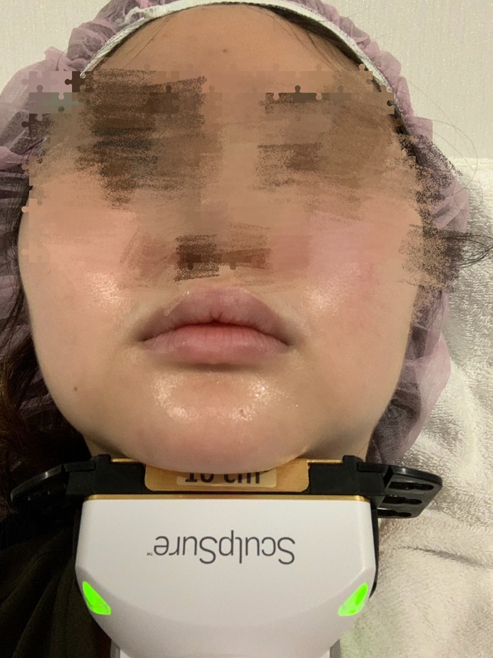 終於受不了自己的雙下巴了😆