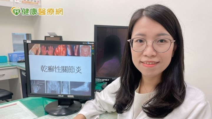 點我看大圖 老師總是穿長袖、被誤認傳染病乾癬性關節炎把握366原則