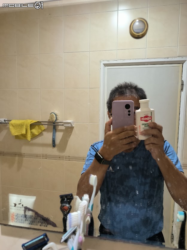 Alpecin Scalp care 油性頭皮專用洗髮露，神奇的讓油膩及頭髮髒亂消失 二個月心得
