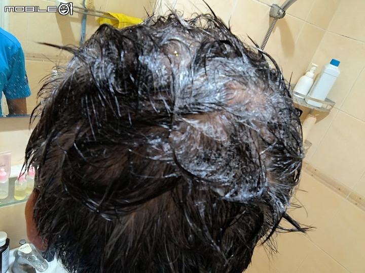 Alpecin Scalp care 油性頭皮專用洗髮露，神奇的讓油膩及頭髮髒亂消失 二個月心得