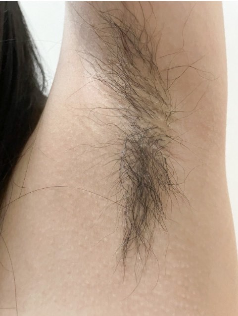 迎接夏日的自信魅力 美麗無煩惱~