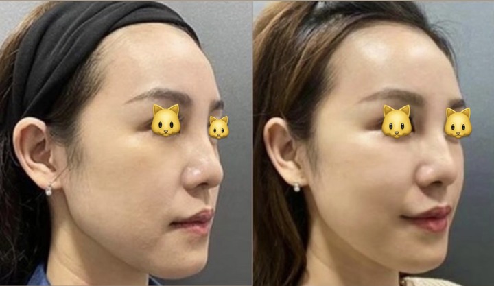 點我看大圖 做埋線提美拉線雕,沒想到效果這樣!圖多