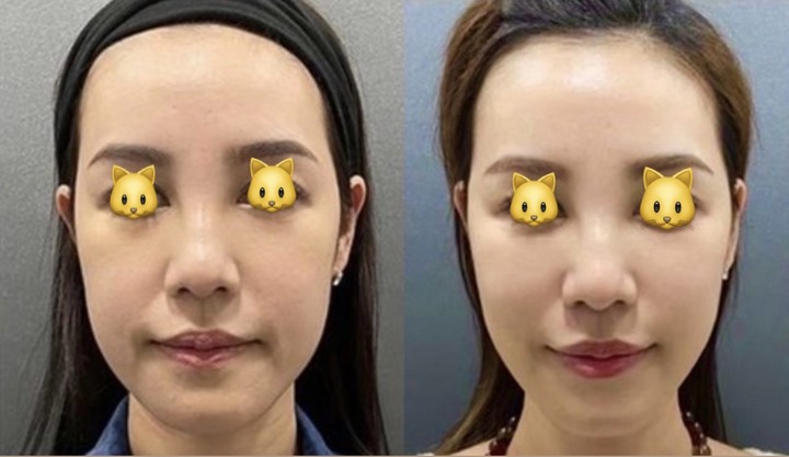 點我看大圖 做埋線提美拉線雕,沒想到效果這樣!圖多