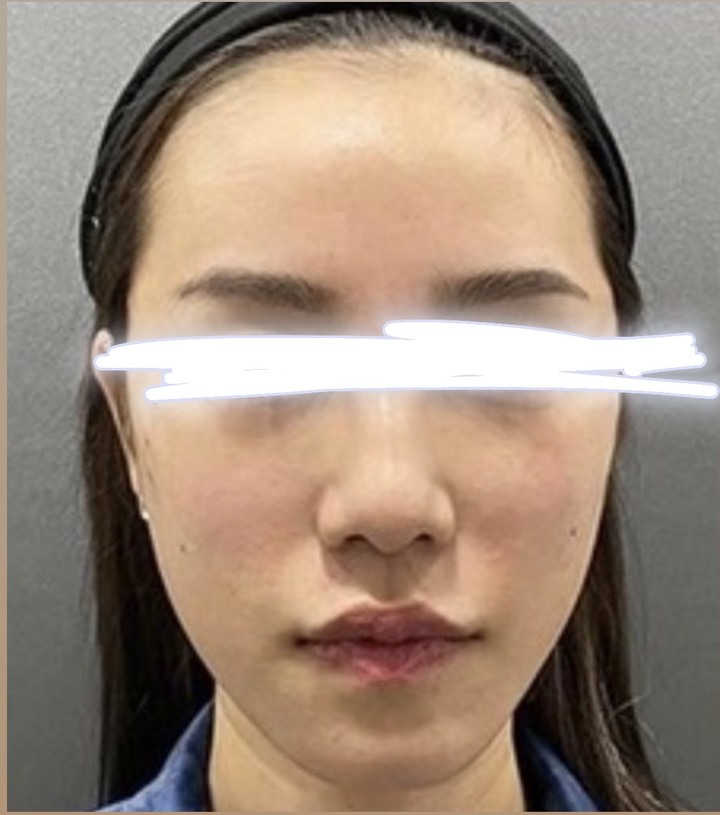 點我看大圖 做埋線提美拉線雕,沒想到效果這樣!圖多