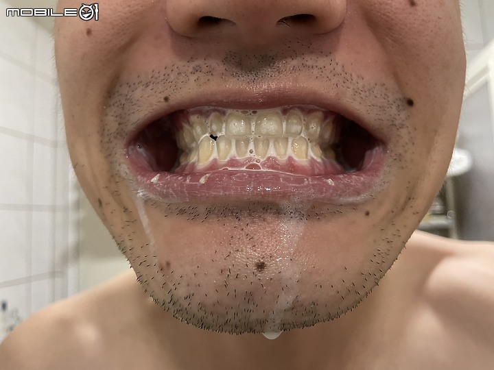 點我看大圖 <使用心得> Bioniq® 貝歐尼 修復+護齦牙膏:護齦加強的全方位呵護體驗