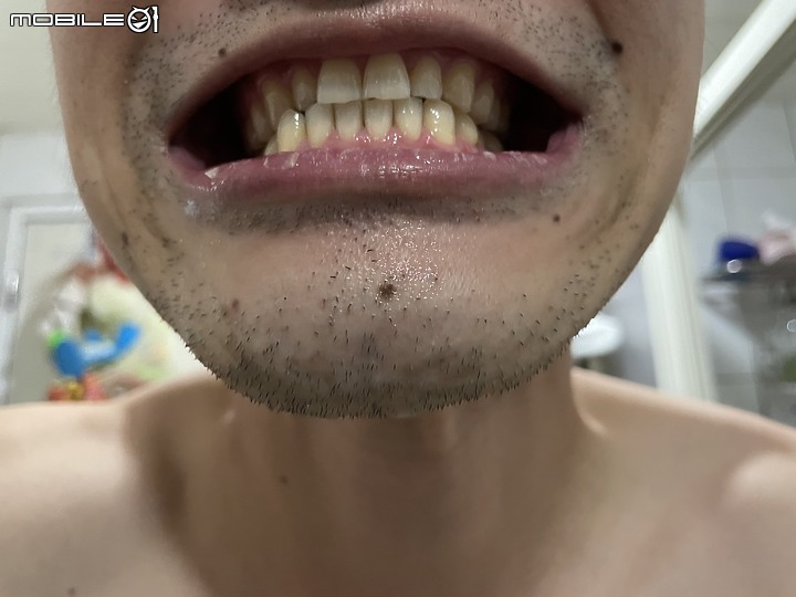 點我看大圖 <使用心得> Bioniq® 貝歐尼 修復+護齦牙膏:護齦加強的全方位呵護體驗