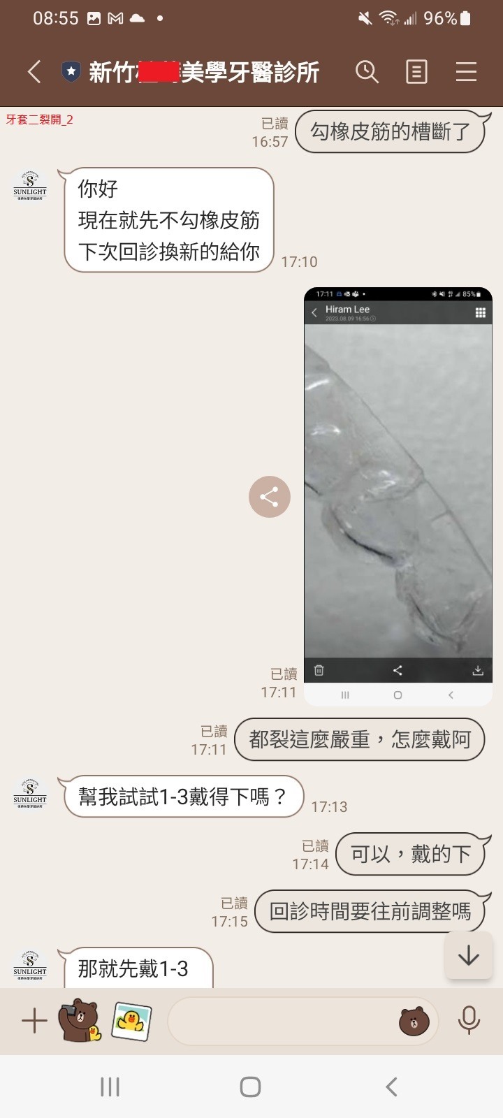 SOV 隱形牙套紀錄, 連續三副牙套都提早壞掉??!! [SOV][SMILUX][舒服美][樂齒][牙套][牙醫][橙蒔][裂開][損壞][缺點]