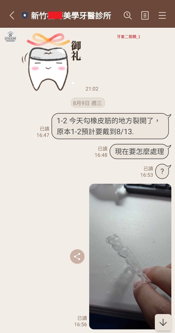 SOV 隱形牙套紀錄, 連續三副牙套都提早壞掉??!! [SOV][SMILUX][舒服美][樂齒][牙套][牙醫][橙蒔][裂開][損壞][缺點]