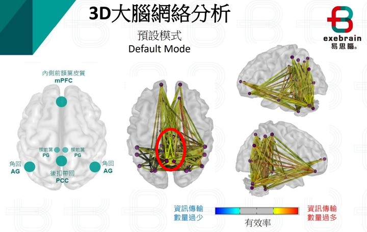 易思腦-心腦波量測 幫我找到身心疲累的原因