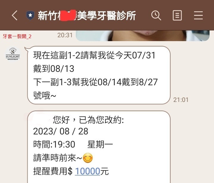 SOV 隱形牙套紀錄, 連續三副牙套都提早壞掉??!! [SOV][SMILUX][舒服美][樂齒][牙套][牙醫][橙蒔][裂開][損壞][缺點]