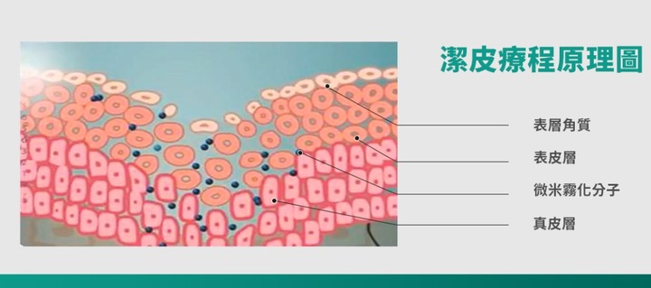 防止落髮大家都有哪些頭皮養護小撇步？
