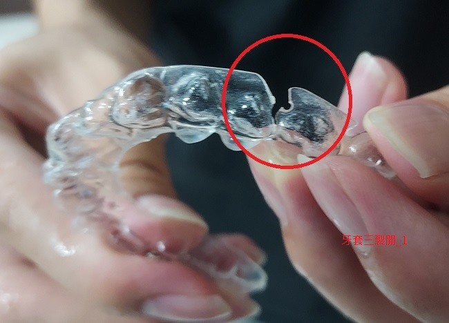 SOV 隱形牙套紀錄, 連續三副牙套都提早壞掉??!! [SOV][SMILUX][舒服美][樂齒][牙套][牙醫][橙蒔][裂開][損壞][缺點]