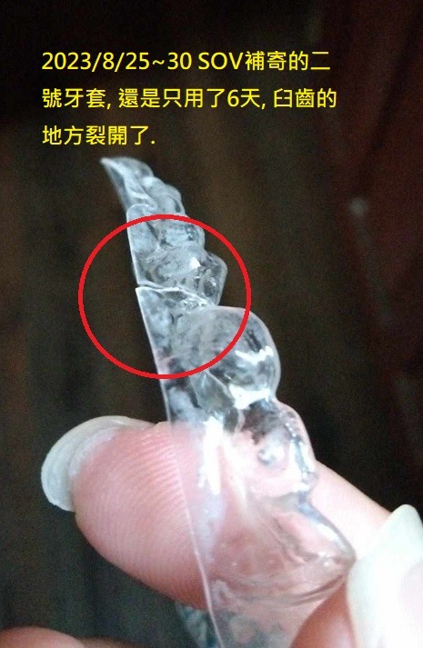 SOV 隱形牙套紀錄, 連續三副牙套都提早壞掉??!! [SOV][SMILUX][舒服美][樂齒][牙套][牙醫][橙蒔][裂開][損壞][缺點]